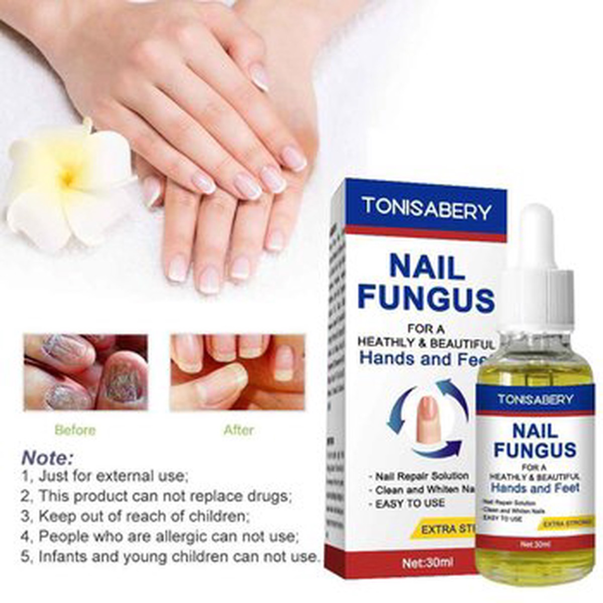 TONISABERY TONISABERY Nail Essence Treatment Solution For Onychomycosis 30ml